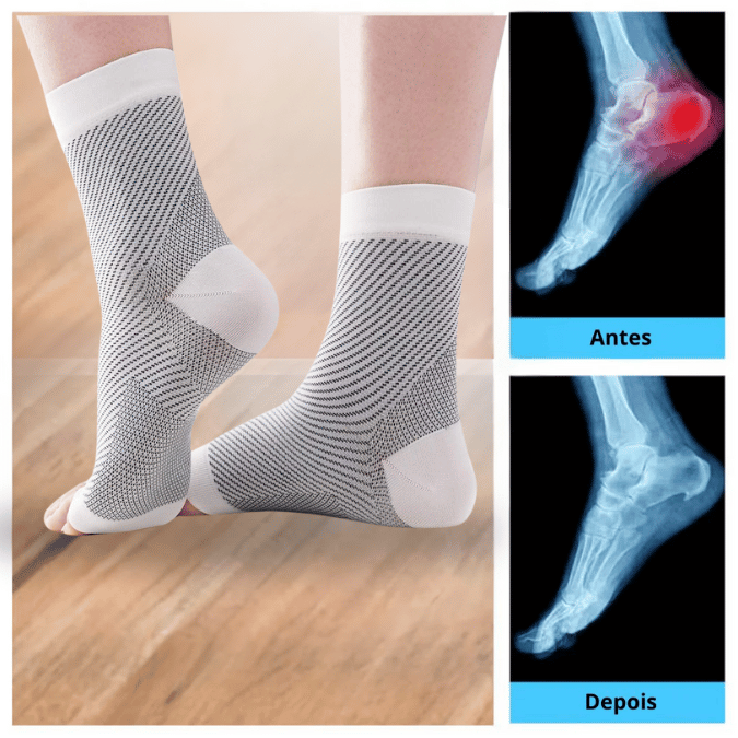 ORTOLeve™ - Tratamento para Neuropatia, Má Circulação e Fascite Plantar